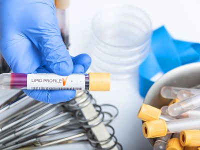 Why Lipid Testing Should Start at Age 8 (Yes, Really)