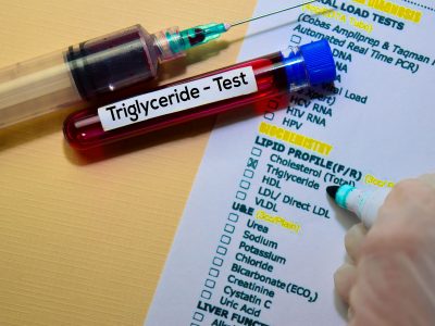 Your Cholesterol Might Look “Normal”—But Is It Lying to You?